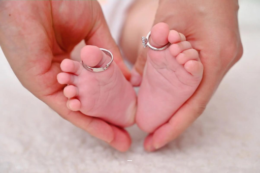 宜昌孕妇怎样预防妊娠纹